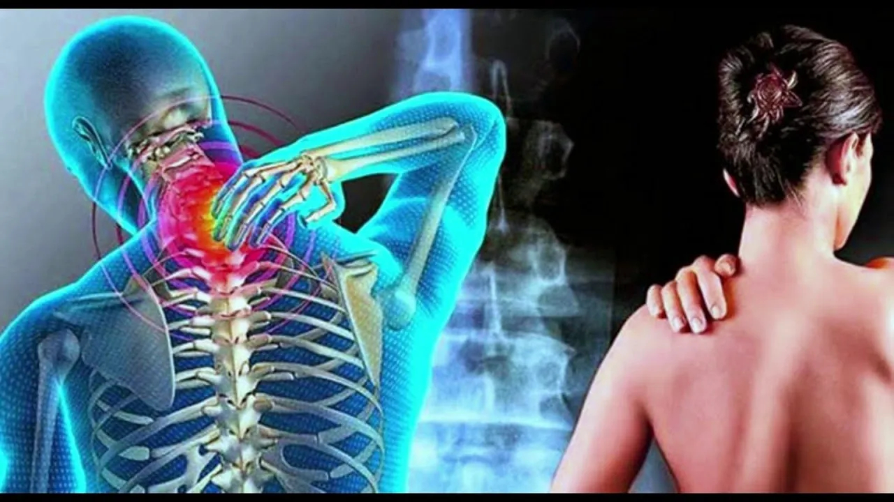 Fibromialgia