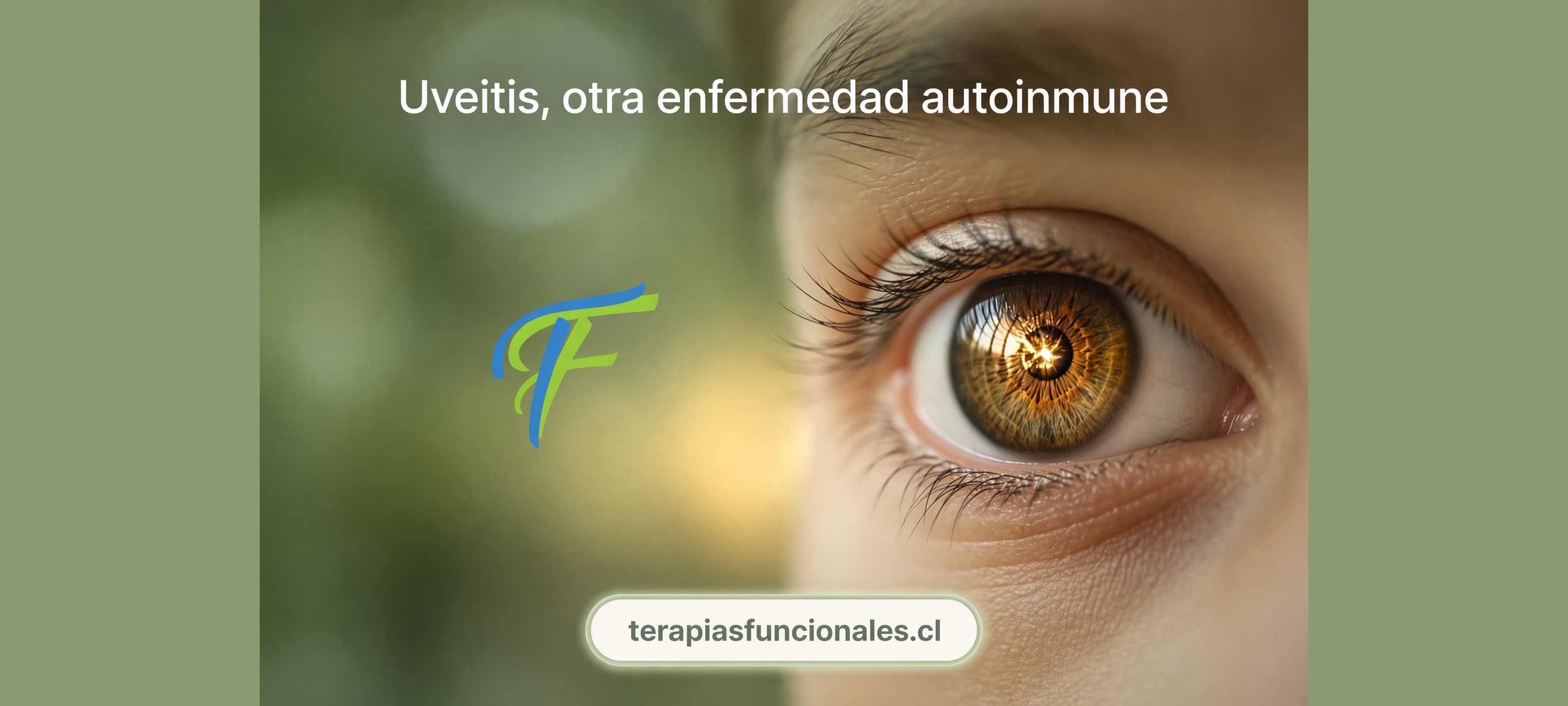 Uveítis infantil y su vínculo con la artritis idiopática juvenil